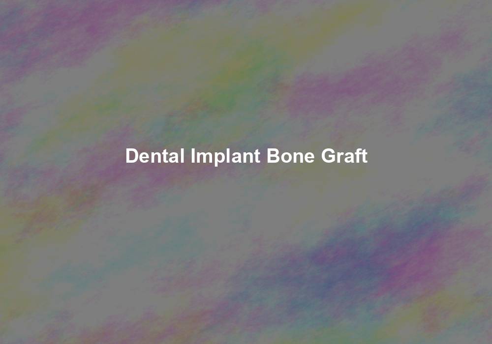 Dental Implant Bone Graft: A Comprehensive Overview