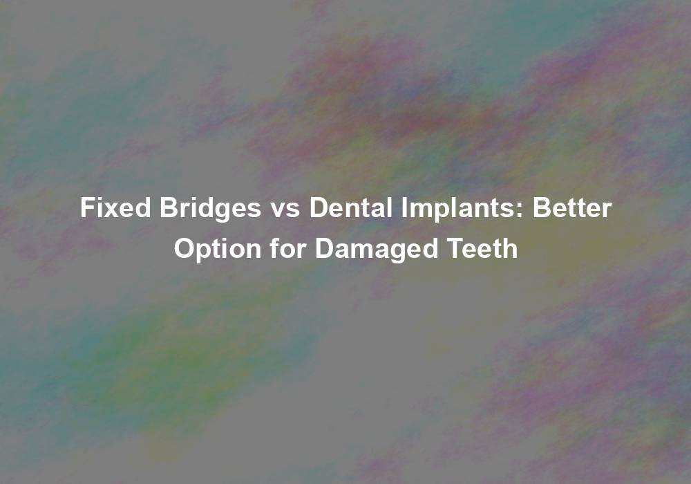 Fixed Bridges vs Dental Implants: Better Option for Damaged Teeth