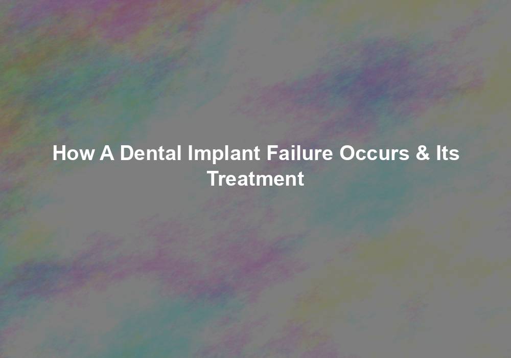 How A Dental Implant Failure Occurs & Its Treatment