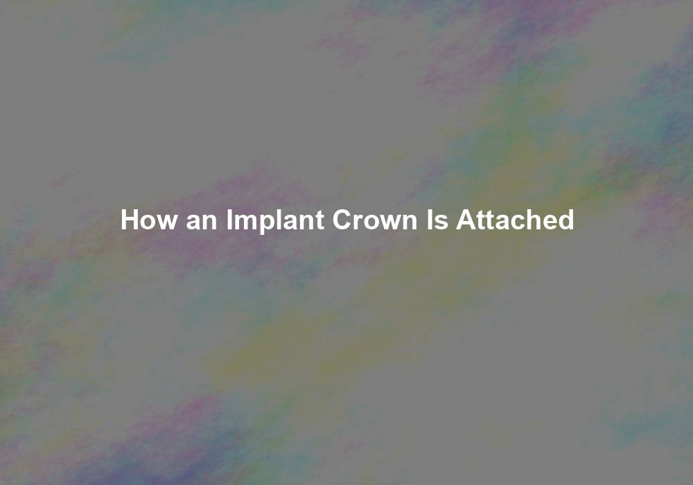 How an Implant Crown Is Attached