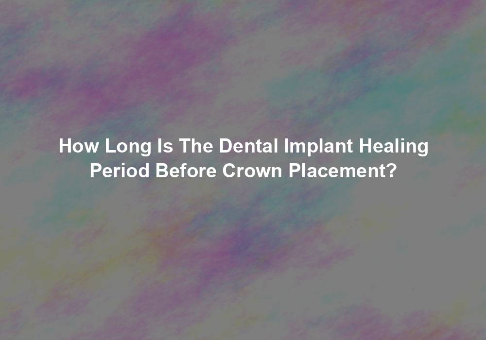 How Long Is The Dental Implant Healing Period Before Crown Placement?